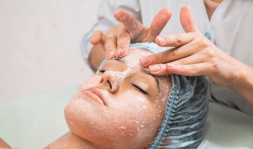 CHEMICAL PEEL